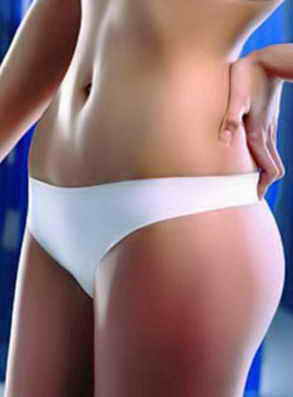 Jolidon ������� ������